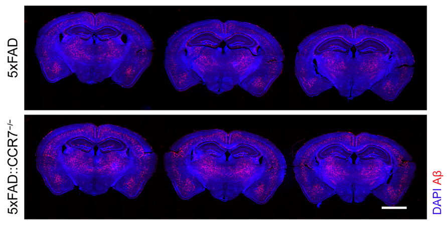 As mice age, T cells linger in the meninges of the brain, which dampens both glymphatic flow and clearance of Aβ plaques. @WUSTL ow.ly/dX1950EW8Sm