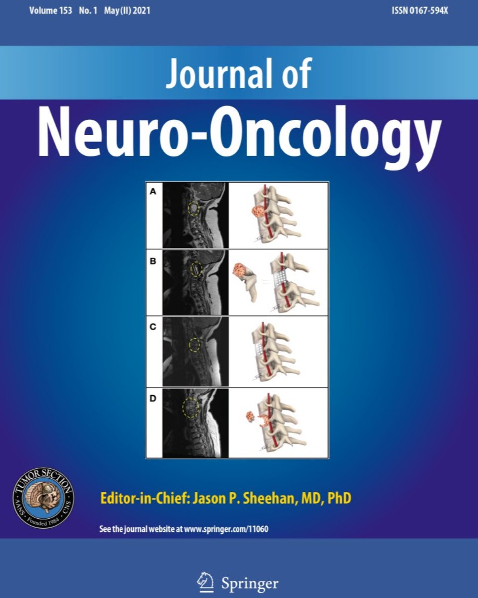 Journal of Neuro-Oncology (@jneurooncol) on Twitter photo Check out the latest issue of the Journal of Neuro-Oncology!
link.springer.com/journal/11060/…
Cover art from an article on cervical #chordomas by #OluwaseunAkinduro <a href="/MohamadBydon/">Mohamad Bydon, M.D.</a> <a href="/MJClarkeMD/">Michelle J. Clarke</a> <a href="/DoctorQMd/">Dr. Alfredo Quiñones-Hinojosa</a> #nsgy #btsm Check out the latest issue of the Journal of Neuro-Oncology!
link.springer.com/journal/11060/…
Cover art from an article on cervical #chordomas by #OluwaseunAkinduro <a href="/MohamadBydon/">Mohamad Bydon, M.D.</a> <a href="/MJClarkeMD/">Michelle J. Clarke</a> <a href="/DoctorQMd/">Dr. Alfredo Quiñones-Hinojosa</a> #nsgy #btsm