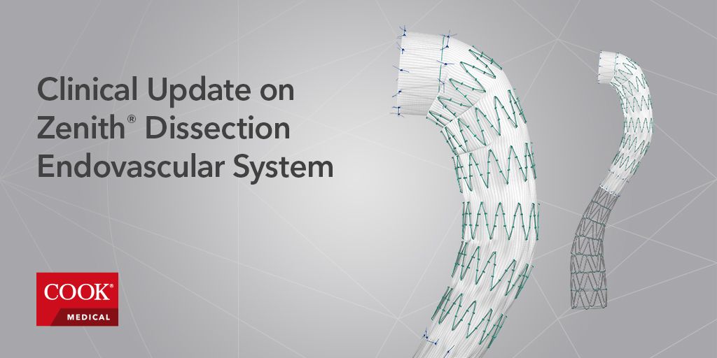 cookvascular's tweet photo. Check out our 1-year data on the Zenith Dissection Endovascular System. https://t.co/gdEkyHjO3m #ZenithDissection #CookVascular #endovascular https://t.co/snQTBTAzEY