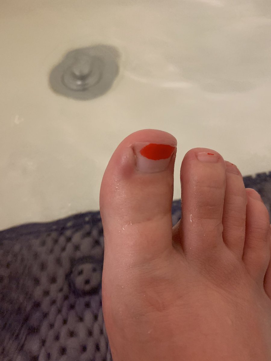 tinyhandsmcgee's tweet image. Well there goes my shot at selling feet pics. Also welcome to my epsom salt soak