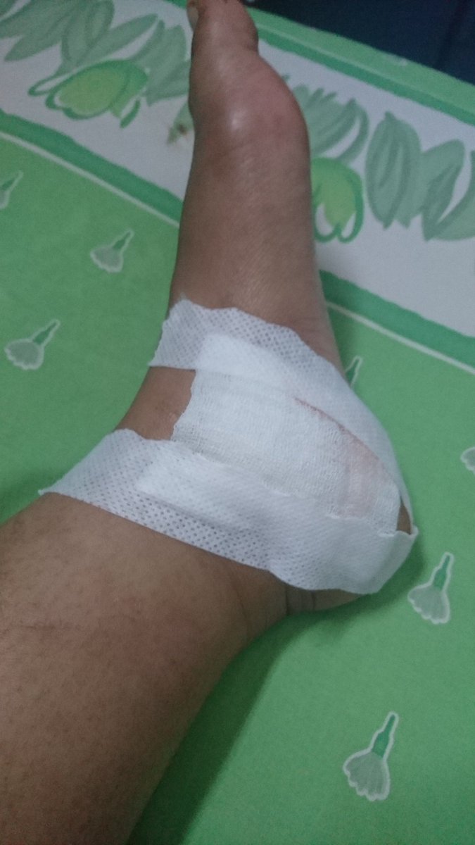 Biasa liat daging sapi daging ayam, giliran liat daging diri sendiri kaget lemesnya bukan main, mana darah ngucur banget kek keran bocor ☺