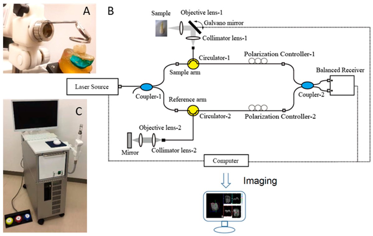 Sensors_MDPI's tweet photo. Diagnosis of Occlusal Caries with Dynamic Slicing of 3D #OpticalCoherenceTomography Images @arsadr78 @TMDUniversity @okayama_uni @UWDentalSchool
👉https://t.co/QTDquHQyWl
#dentin
#enamel
#radiograph
#receiveroperatingcharacteristic
#hiddencaries
#dentinoenameljunctionDEJ https://t.co/ARicRz18Rw
