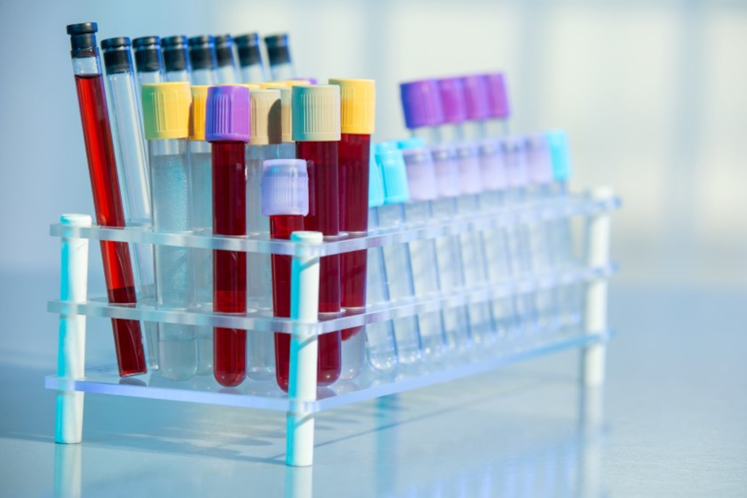 Genethique's tweet photo. Le déploiement du #DPNI en Angleterre laisse présager une augmentation des IMG
#IVG #trisomie21
https://t.co/VOfBr4UfOK https://t.co/8uwswTR0NF