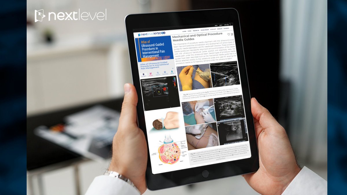 New on NextLevel NYSORA
✨Atlas of Ultrasound-Guided Procedures in Interventional Pain Management is the first book devoted to the new, rapidly expanding field of ultrasound-guided pain medicine (USPM). Learn more: nextlevelcme.com/atlas-of-pain-…

#nysora #pain #painmanagement #nerve
