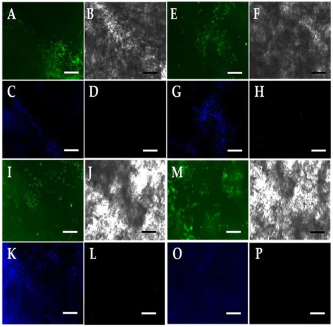 CancerNemi's tweet photo. The Effects of Crosslinking on the Rheology and Cellular Behavior of Polymer-Based 3D-Multilayered Scaffolds for Restoring Articular Cartilage

Yaima Campos et al.

|Polymers|

https://t.co/A8BGJNv6Jd

#H2020 #MSCA #cancerproject https://t.co/jUjlKDbqAF