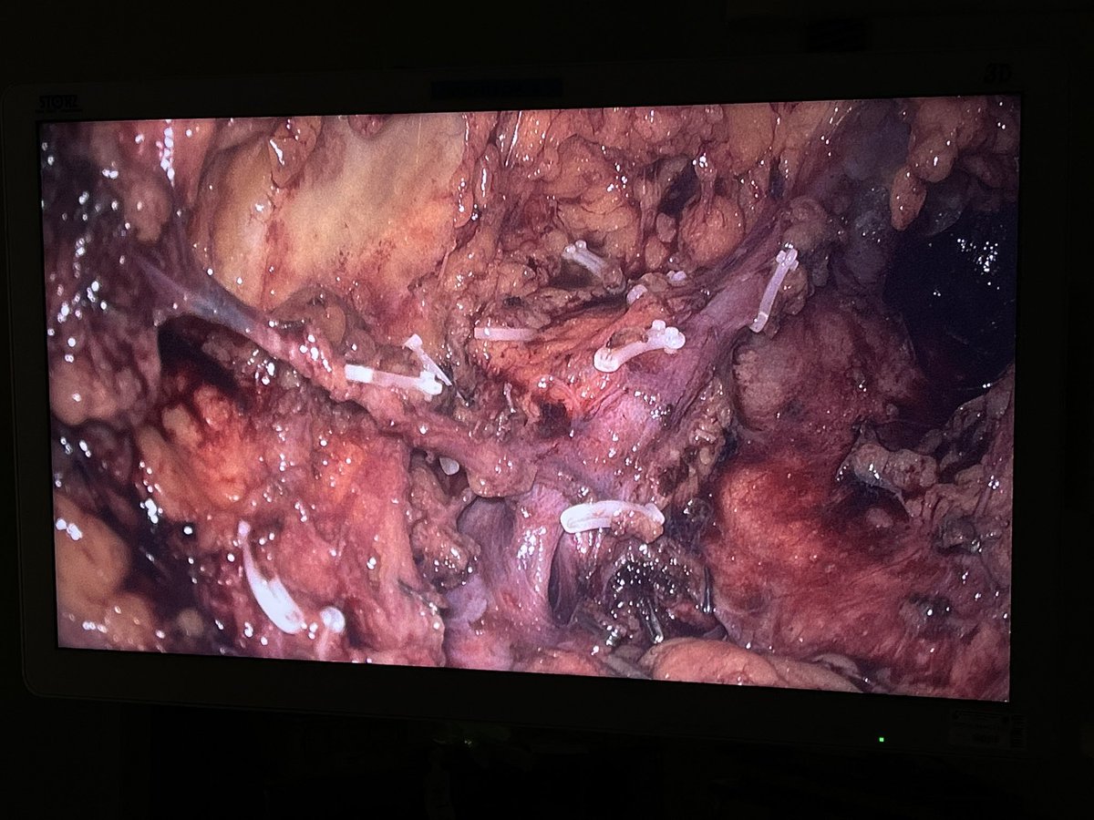 Urología Hospital Infanta Sofía tweet media