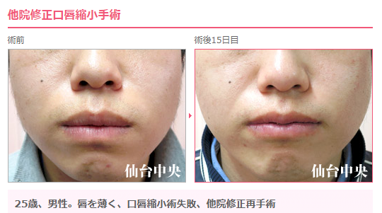 唇を薄く Twitter Search Twitter