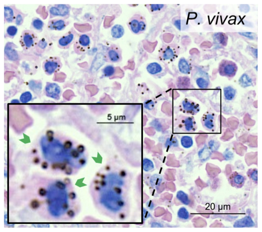 Freddy Frischknecht tweet media