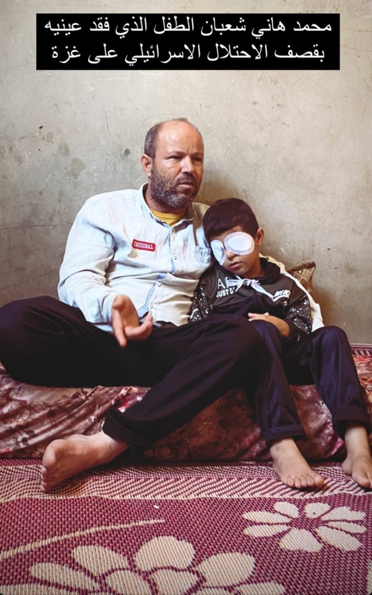 GuedouarJoy's tweet photo. A child lost his eyes cause of #IsraeliWarCrimes.
#israelmustpay
#IsraelTerrorism https://t.co/8XyCcybcm4