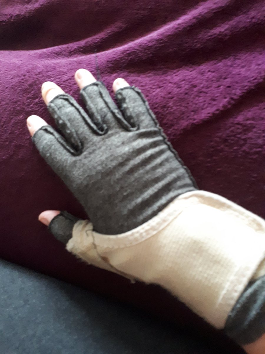 sirenmoonbee's tweet photo. Warm weather lovely, compression gloves and splints in warm weather, not quite as nice #InflammatoryArthritis #CMCjoint #ErosiveOsteoarthritis https://t.co/01PKd1ibsO
