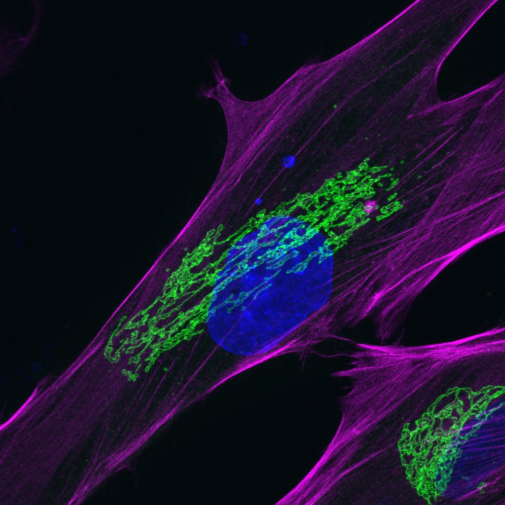 brehewitt's tweet photo. Super excited to announce that I am joining The Petrie Lab and studying 3D cell migration! Please enjoy one of my fav pics from my rotation #phdchat #ScienceTwitter #AcademicTwitter #thesislab #cellculture #golgi #CellBiology #Science #ScienceIsArt #CellMigration #Biology https://t.co/PvyyJJO5g7