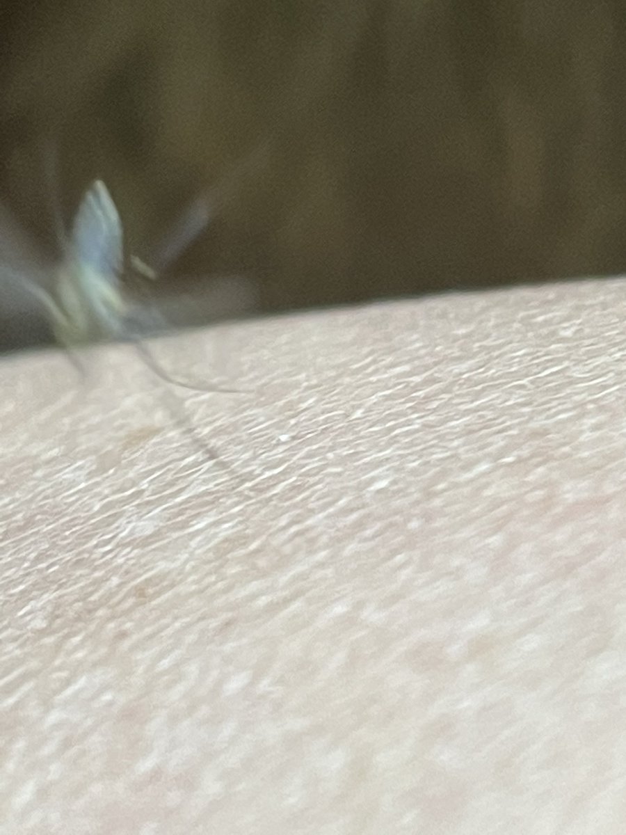 Bird people have #worstbirdpic so I’d like to introduce entomologists to #worstmosquitopic
This is Aedes triseriatus 😬