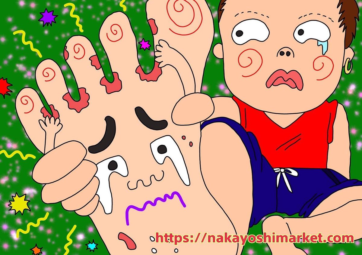 なかマケ イラスト雑学ブログ毎日更新 6月4日は 水虫治療の日 今日はなったら嫌な 水虫 の イラスト と 雑学 を ブログ で更新 T Co R5jh2nxqbk これも水虫予備軍 水虫って治るの 水虫にならないようにするには 水虫