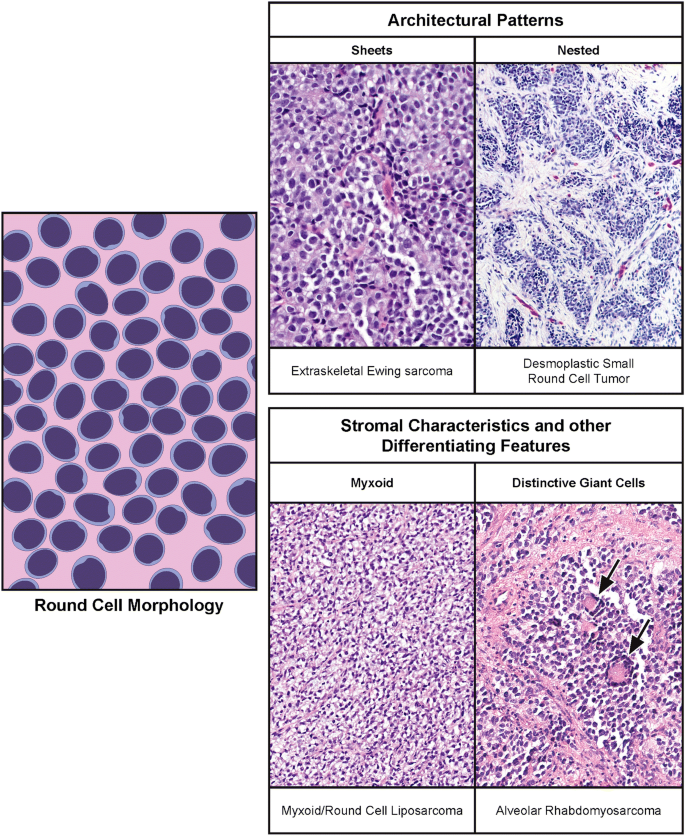 thejourneymate's tweet photo. Common Soft Tissue Tumors by Morphology: In Illustrations 🔬
https://t.co/s7PR7tgdD2 https://t.co/6z3fT5PHmk