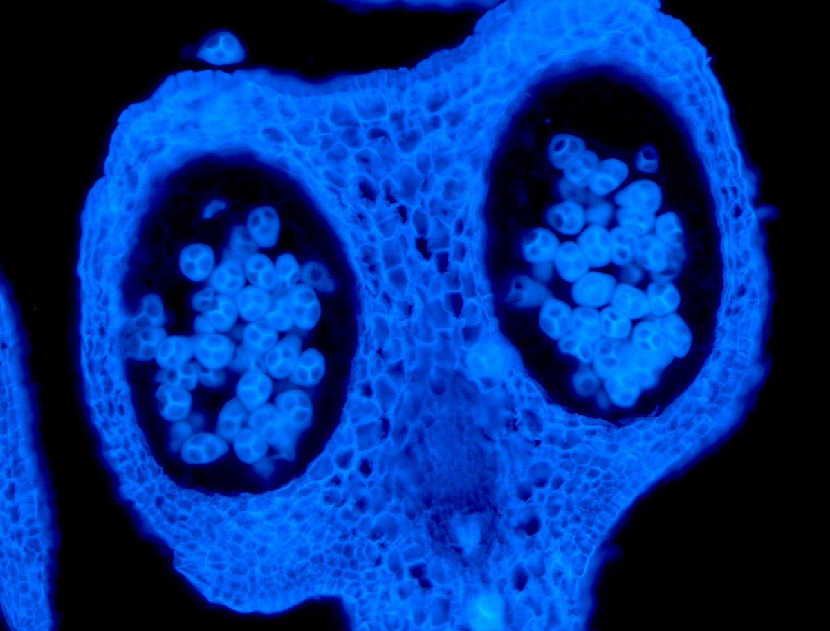 0_minyaaa's tweet image. Pollens looking like little screaming faces 😱 trapped in chambers and I&apos;m loving it. These faces are in fact evidence of meiosis. 
#SciArt #microscopeart #iamabotanist #BestTimeisMicroscopeTime #pollens #meiosis #tetrads