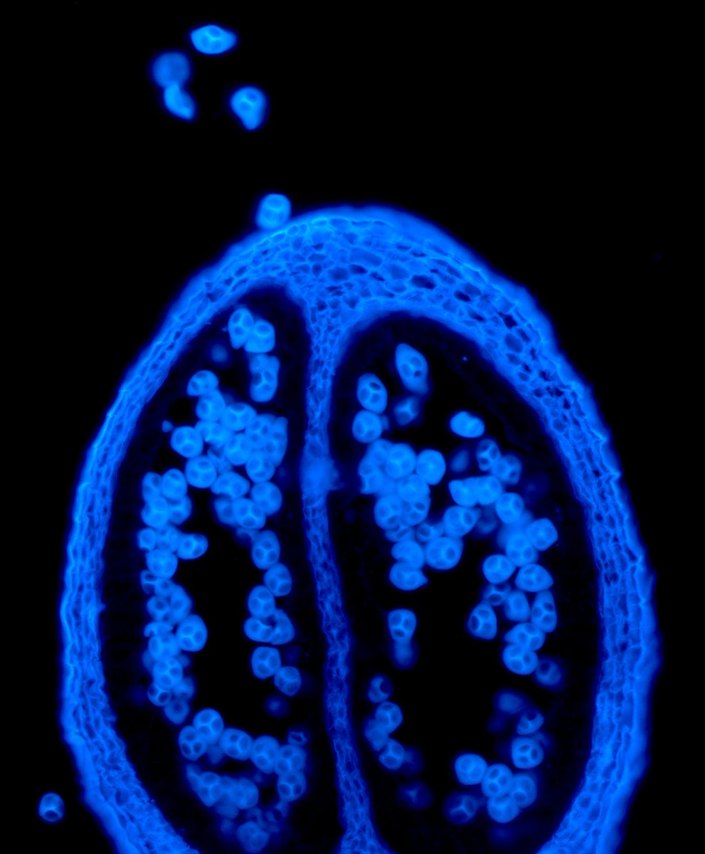 0_minyaaa's tweet image. Pollens looking like little screaming faces 😱 trapped in chambers and I&apos;m loving it. These faces are in fact evidence of meiosis. 
#SciArt #microscopeart #iamabotanist #BestTimeisMicroscopeTime #pollens #meiosis #tetrads