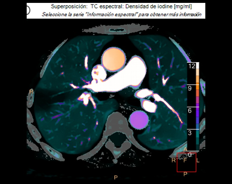 Eliseo Vañó tweet media
