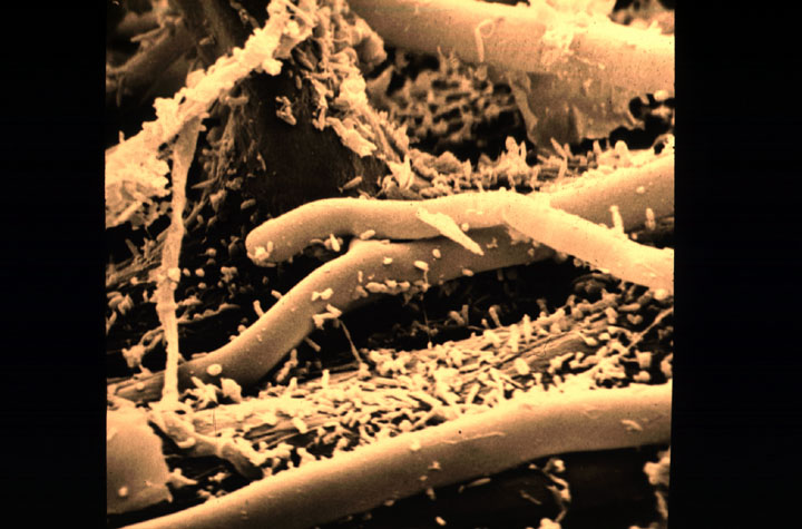 Бактерии разлагающие органические вещества. Бактерии гниения. Бактерии разложение и гниение 5 класс биология. Бактерии гниения. Сапротрофы бактерии брожения.