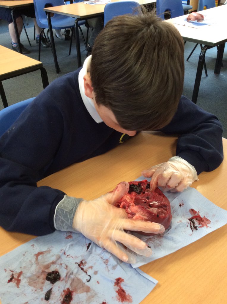 FryattRebecca's tweet photo. @GreenwoodSch @MissHickton @FhtYear6 What an amazing afternoon dissecting pig hearts to consolidate our learning for our enquiry ‘How can we save lives?’ We were very lucky to have an expert on hand, cardiac nurse - Holly Younger! https://t.co/VaW5Liy1XY