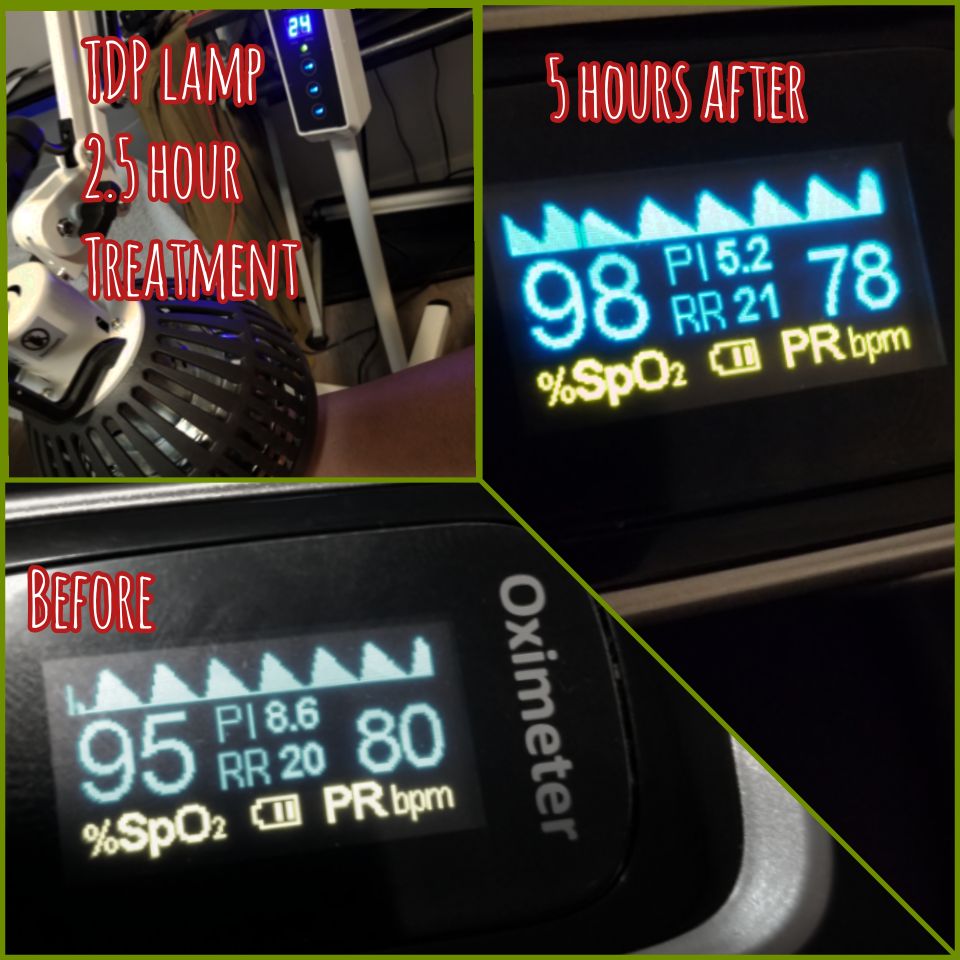 IceAge_Farming's tweet image. My TDP electromagnetic wave infrared heat lamp experience, results from 2.5 hours of use.  My oximeter readings. What do you think of this?