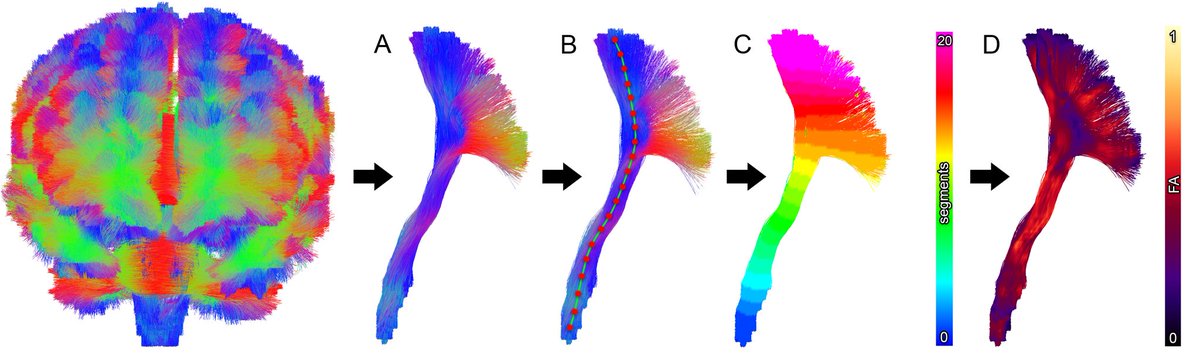 MaxChamb's tweet photo. Join us next week to learn about diffusion MRI #tractometry @OHBM
My talk will cover topics like exploratory data analysis, dimensionality reduction and anomaly detection principles - see you there!
#OHBM21 https://t.co/SLWjcp9mTK