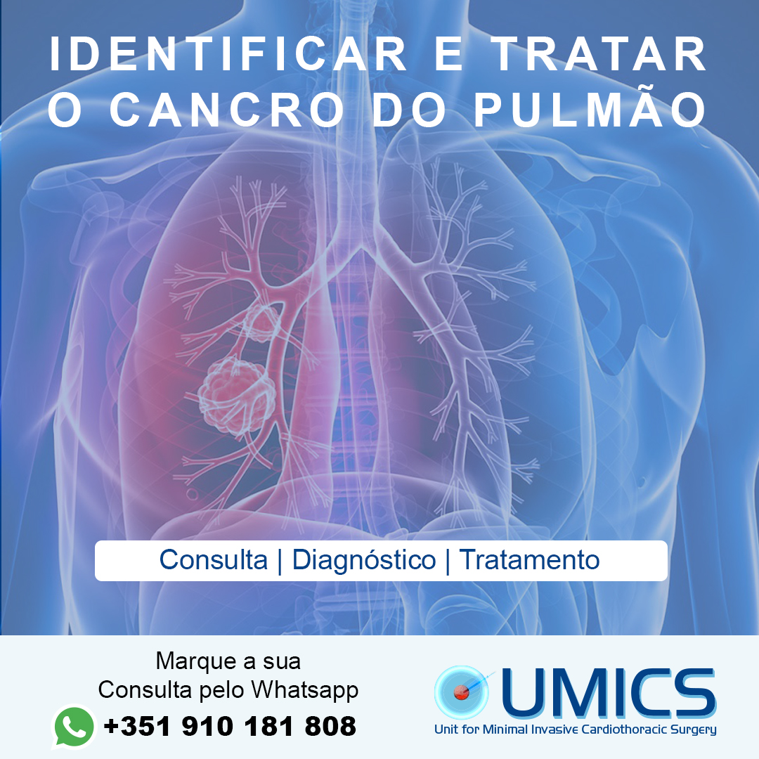 UmicsSurgery's tweet photo. O cancro no pulmão é o segundo tipo de câncer que mais cresce no mundo, sendo superado apenas pelo número de casos de cancro da pele.

Saiba mais: https://t.co/cq2E2Dazhc
#ProfDrJavierGallego #Consultas #CancerPulmao #Pulmao #Diagnostico #Cancer https://t.co/qLMuqHb86x