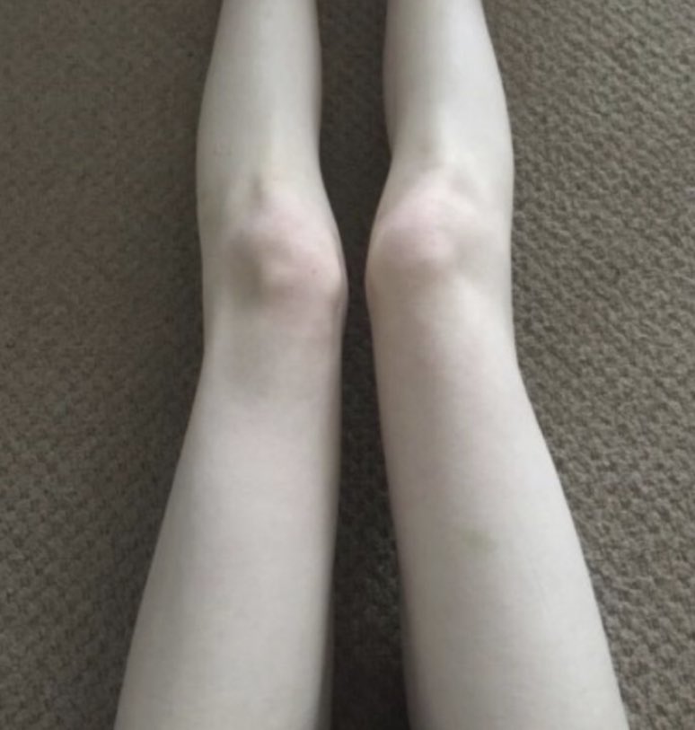 mikaaeelaaa's tweet photo. in need of edtwt moots 🪦
——————————————
*she//her
*14
*thinspo//meanspo//sweetspo//fatspo
*cw:113 // gw : 95
*dms r always open , i <3 new friends https://t.co/z3GcyNOFVE