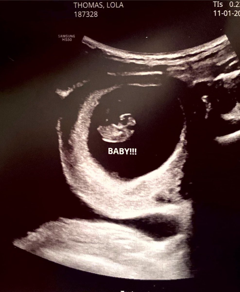 alan benjamin thomas tweet media