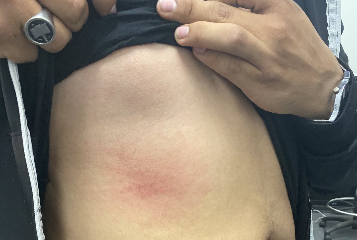 SoyIsaacML's tweet image. #Indignante 😡 Así es como el equipo  de @RiveraVivanco_ nos ataca a golpes y patadas solo por hacer nuestro trabajo de informar, adjunto las pruebas.