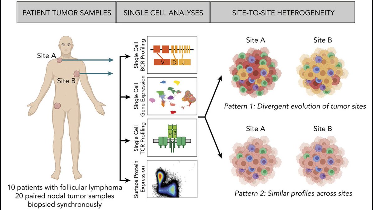 Excited to share our recent work with <a href="/tanaya_shree/">Tanaya Shree</a> in @BloodJournal on divergent evolution in lymphoma. Grateful for mentorship by Ron Levy and the collaboration with the Hanlee Ji lab &amp; all coauthors including Anuja Sathe &amp; <a href="/gradycday/">Grady Day</a> #lymsm <a href="/StanfordMed/">Stanford Medicine</a> ashpublications.org/blood/article-…