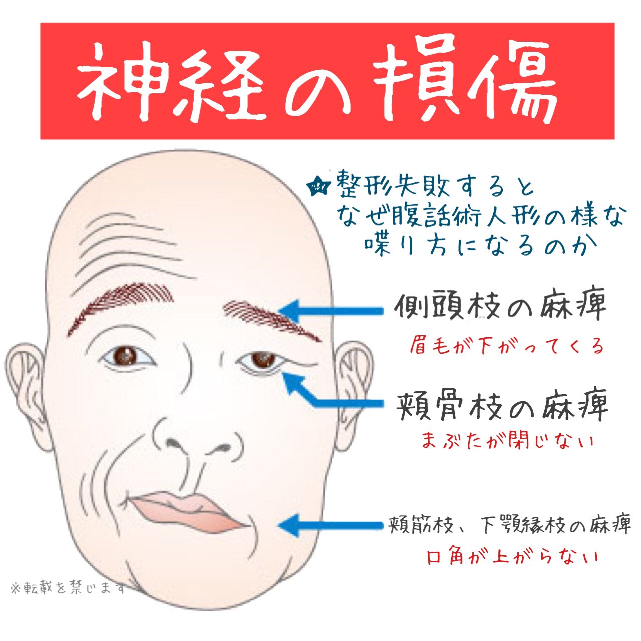 顎削り Twitter Search Twitter