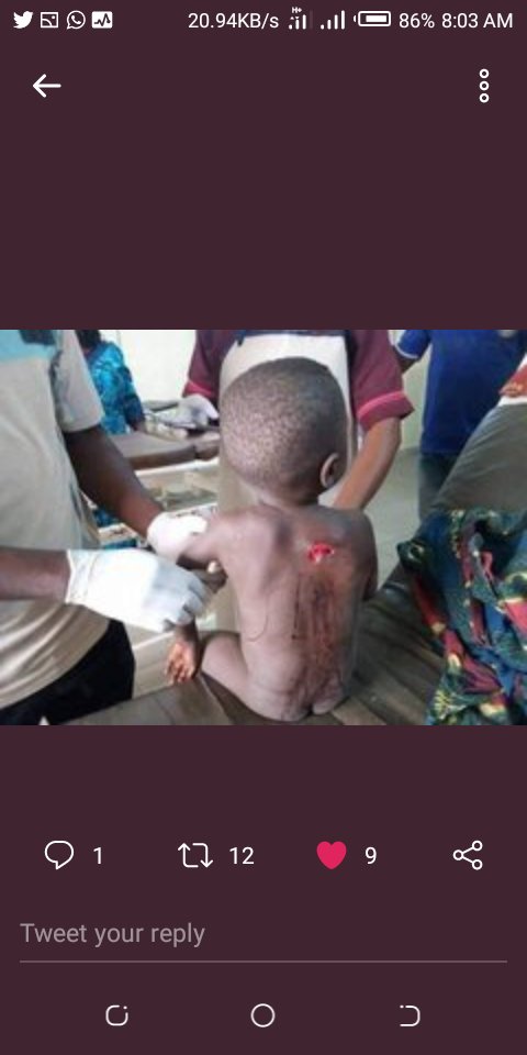 Herrybeth16's tweet photo. "Children are the leaders" of tomorrow. My question is, are Benue children not inclusive in this leadership of tomorrow, why then are life's snatched out of them at this tender age? Why are the casualties? Why render them homeless? Why make the ophans this early
#BenueUnderAttack https://t.co/yzL2TTpvbg