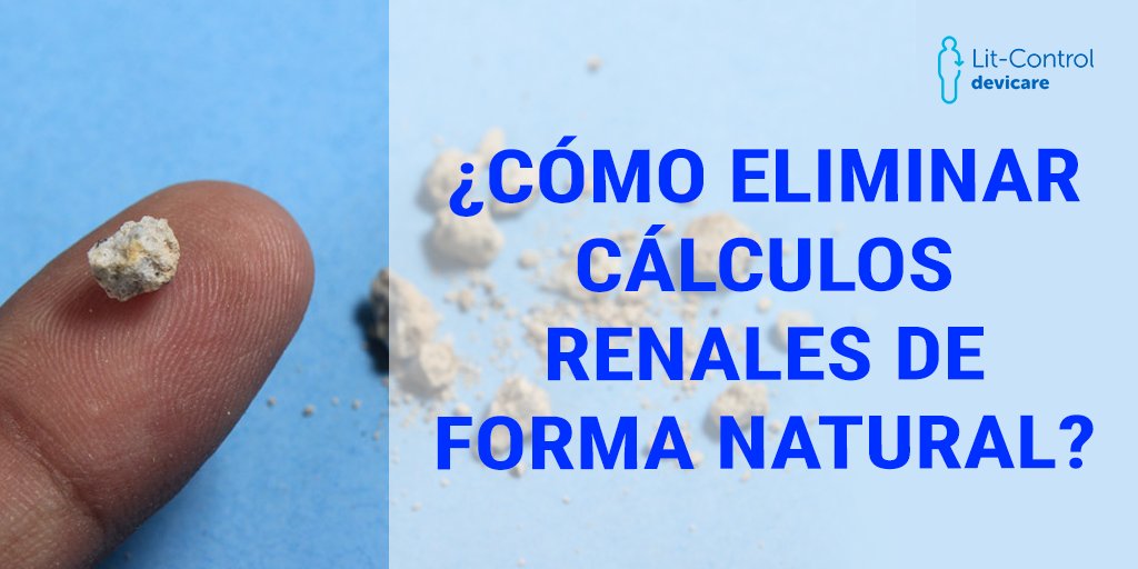 LitControl's tweet photo. Para eliminar un cálculo renal de forma natural hay que identificar primero el tamaño y la posición del cálculo en el sistema urinario. Los cálculos de más de 10 mm son en general difíciles de expulsar de manera espontánea y necesitan cirugía.
#litcontrol
https://t.co/m440JXw4O7 https://t.co/QW8C4QTPLy