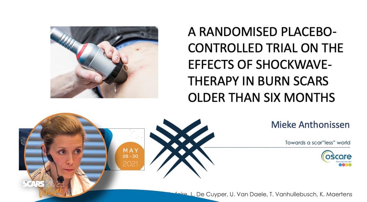 vzwOscare's tweet photo. Mieke Anthonissen vertelt over 'A randomised placebo-controlled trial on the effects of shockwave-therapy in burn scars older than six month.' op het online #SCARS2021 congres.
https://t.co/0qDAVBUfpt
#teamoscare #teamscaracademy #scaracademy https://t.co/aAlPEmGXIv