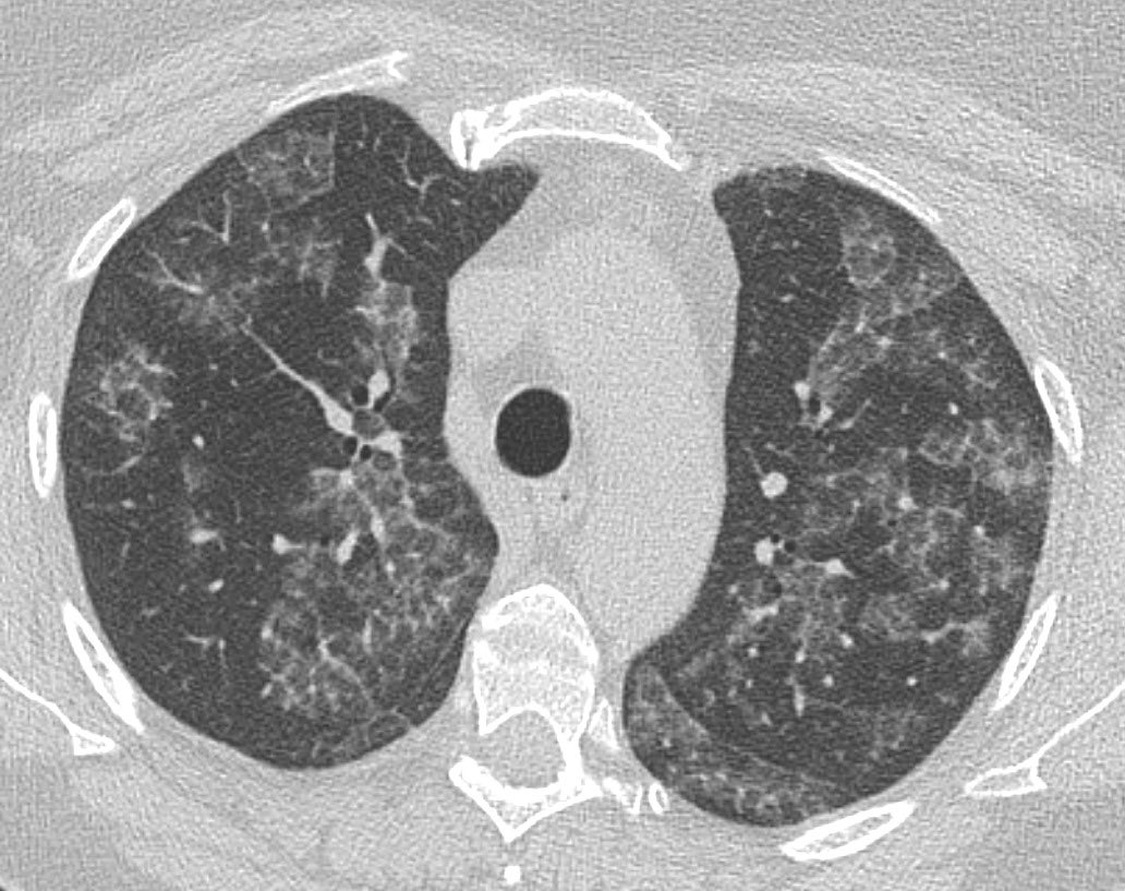 Andre' Carvalho tweet media