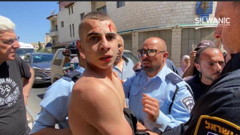 JatIkhwan's tweet photo. Mahkamah Israel menangguhkan keputusan untuk menghalau 7 buah keluarga daripada kawasan kejiranan Batn Al Hawa, Silwan sehingga bulan Disember. Allahuakbar. Moga mereka menang dan kekal di Silwan. Dunia kena terus kritik kes ini agar mereka tertekan. #SaveSilwan https://t.co/lKShCLh8c6