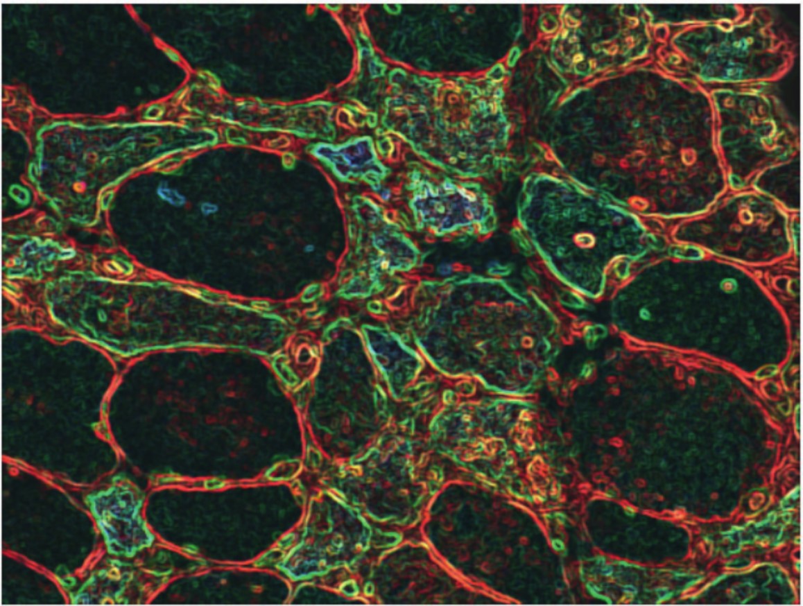 brainpathol's tweet photo. NEW MINI-SYMPOSIUM: RECENT DATA AND DEVELOPMENTS IN #MYOSITIS

Werner Stenzel and Hans Goebel introduce a series of 6 papers that mirror the up-to-date level of research in #myositis and give a perspective on how broadly the field has developed. #neuropath https://t.co/eH68KcI06X https://t.co/rTTxfz1Fwc