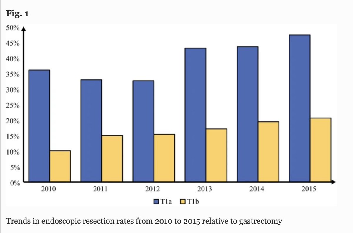 AnnSurgOncol's tweet image. JUNE ISSUE: Local #EndoscopicResection is Inferior to #Gastrectomy for Early Clinical Stage T1a and T1b #GastricAdenocarcinoma: A Propensity-Matched Study. rdcu.be/ck976 @McMastersKelly @SocSurgOnc