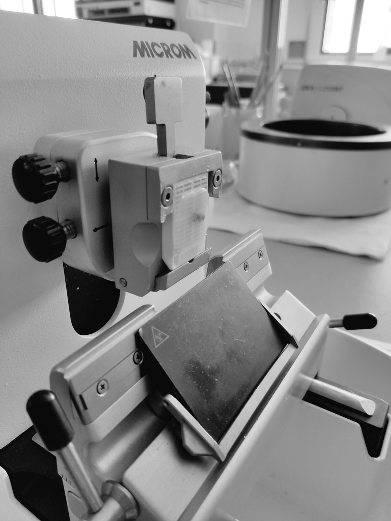 IesSanidad's tweet photo. Novedades 2021/22!! 
Ciclo Grado Superior #AnatomíaPatológicayCitodiagnóstico #DUAL
2cursos académicos 3trimestres en laboratorio de anatomía patológica en hospitales de #Malaga
@IColegiales
@nuevocolegiales #fp
#fpdual #fpandaluza
#antequera #tsapc https://t.co/2d5S8fTJa3