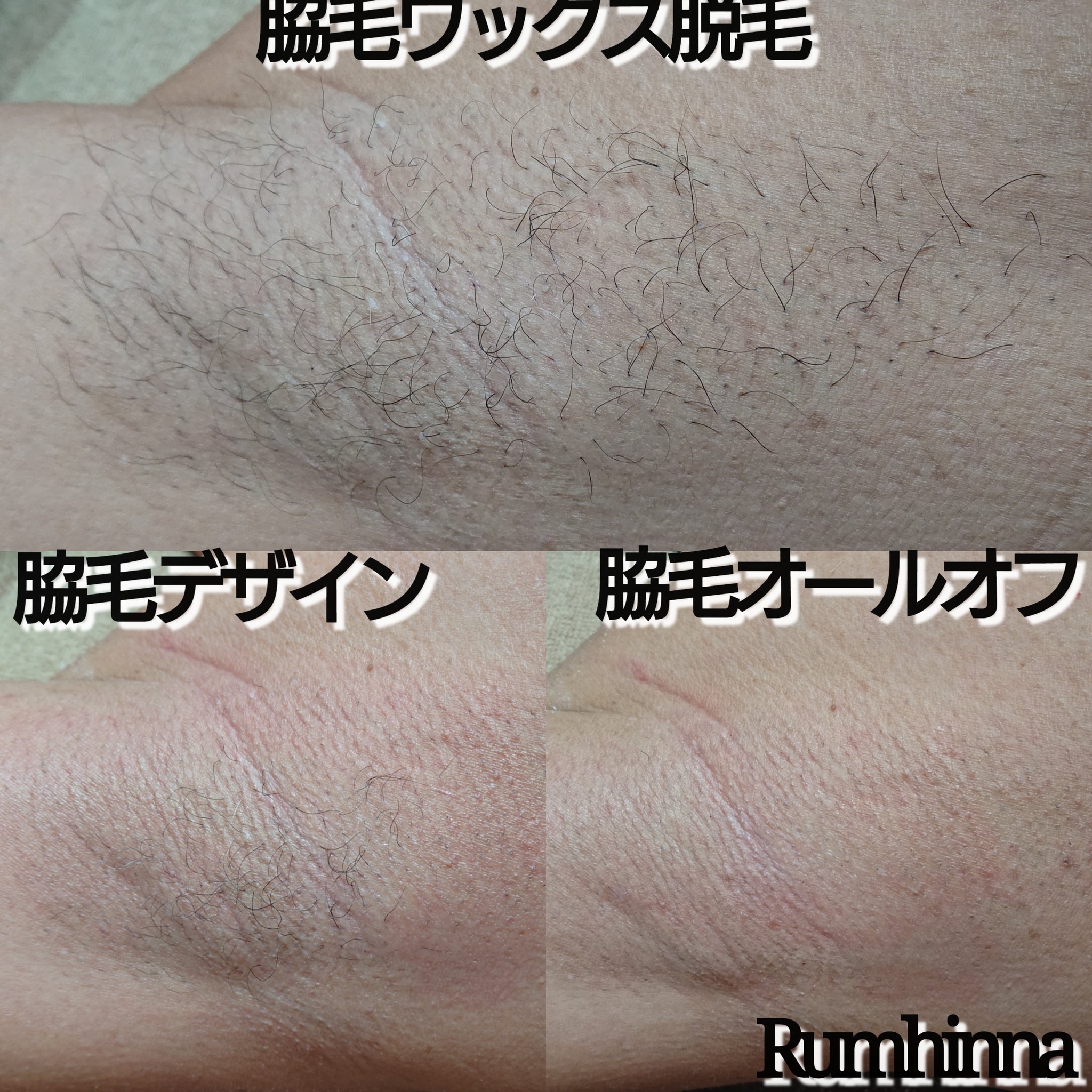ラムヒンナー 個室脱毛リラクゼーションサロン ムダ毛をなくすだけだけが脱毛の目的ではないと思います 日々の生活を快適に過ごす事が出来るのが一番のメリットです 四谷三丁目 曙橋 個室 シャワー完備 ブラジリアンワックス シュガーリング