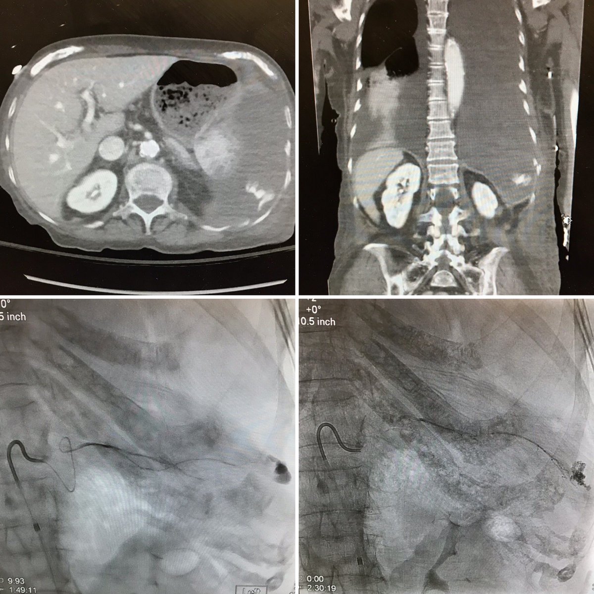 Brown IR tweet media