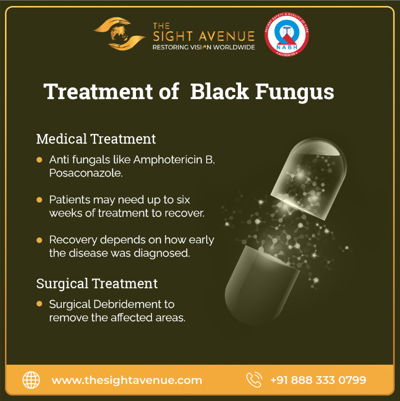 AvenueSight's tweet photo. Treatment of Black Fungus
.
.
#blackfungus #pandemic #epidemic #fungus #covid19 #virus #spread #deadly #blackfungusdiagnosis #symptoms #fightagainstfungus #doctors #healthcare #medical  #thesightavenue #delhihospital #blackfungustreatments #blackfungusrecovery #blackfunguscure https://t.co/b54dSbpr5v