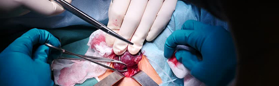 SummitSurgery's tweet photo. #Endocrine medical plan of action is a particular field of medical procedure that spotlights on the treating of subject of the #thyroid, #parathyroid and #adrenalorgans and moreover #endocrinecarcinomas of the #gastrointestinaltract and the #pancreas.
https://t.co/SBqs3Wz6pP https://t.co/hJAh06KYYS