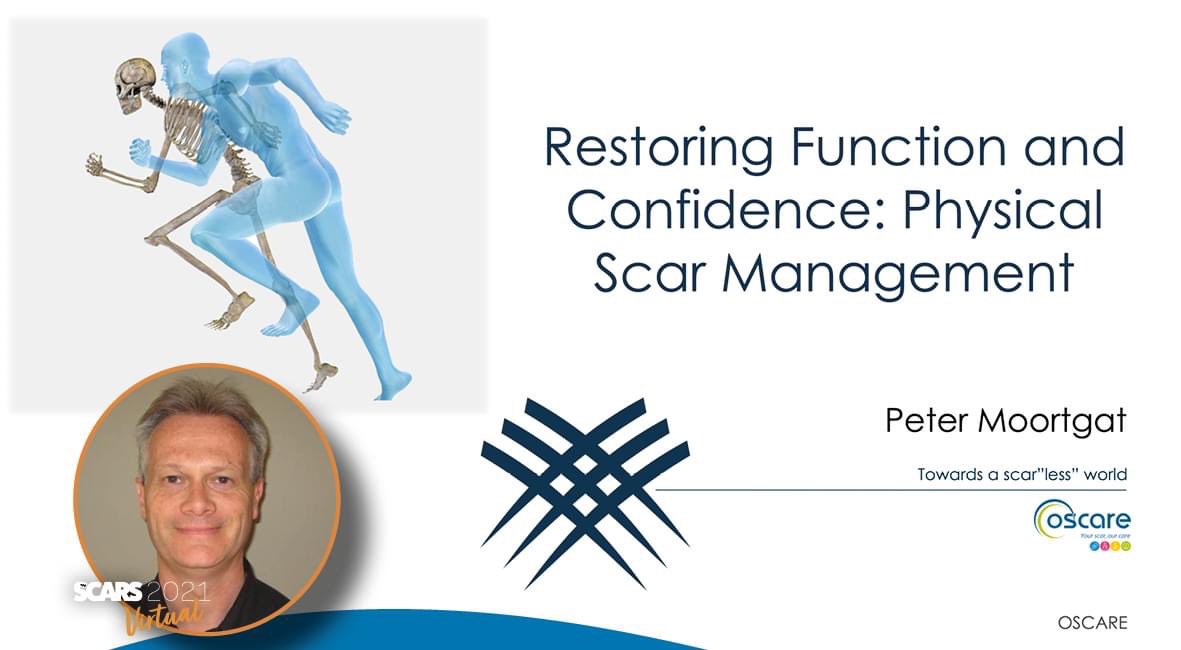 vzwOscare's tweet photo. Peter Moortgat vertelt over 'Restoring function and confidence: Physical scar management.' op het online #SCARS2021 congres.
https://t.co/0qDAVBUfpt
#teamoscare #teamscaracademy #scaracademy https://t.co/n66fhePZyK