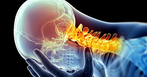 touchNEUROLOGY's tweet photo. Cognitive Dysfunction During Migraine Attacks
Learn more here: https://t.co/QltFGp1oot
#migraine #migraineawareness #migrainelife #migraineattack #neurologists #neurological #Neurologist #neurology #headache #headacherelief #headachetreatment #headacheattack https://t.co/rbCeSfvE1M