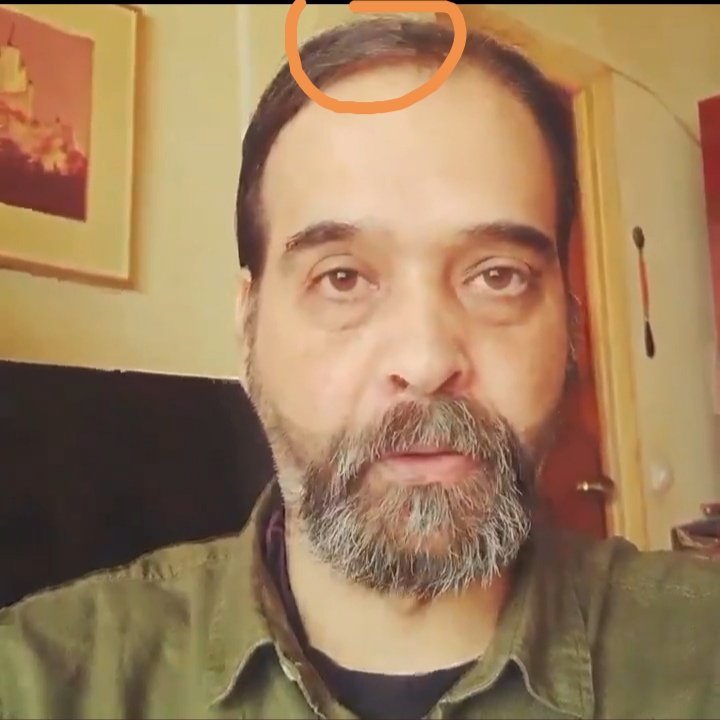 DaVidTowers9's tweet photo. @Ak732R @svazquezgomariz @IrurreSainz @Francis50368404 @JorgedeArlanza En el vídeo de instagram no se ve nada extraño.Adjunto un frame donde se ve también un "fallo" en la parte del pelo. Un saludo https://t.co/zaQcI8T63k