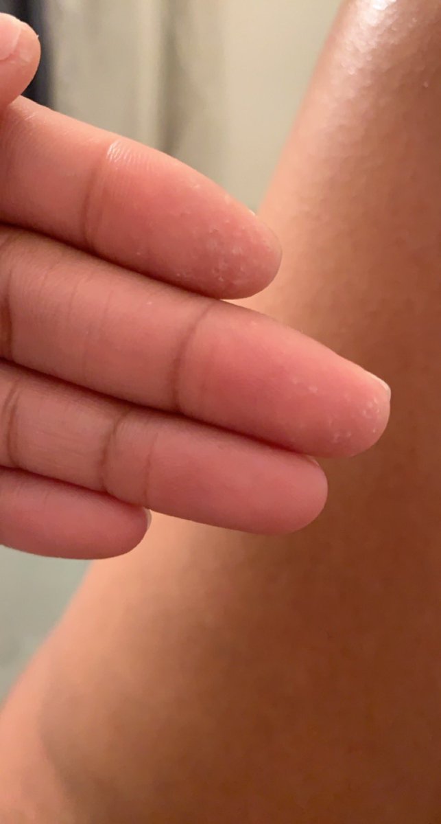 lexual_healin's tweet image. definitely time to invest in some thimbles 😂😭 #SewFun