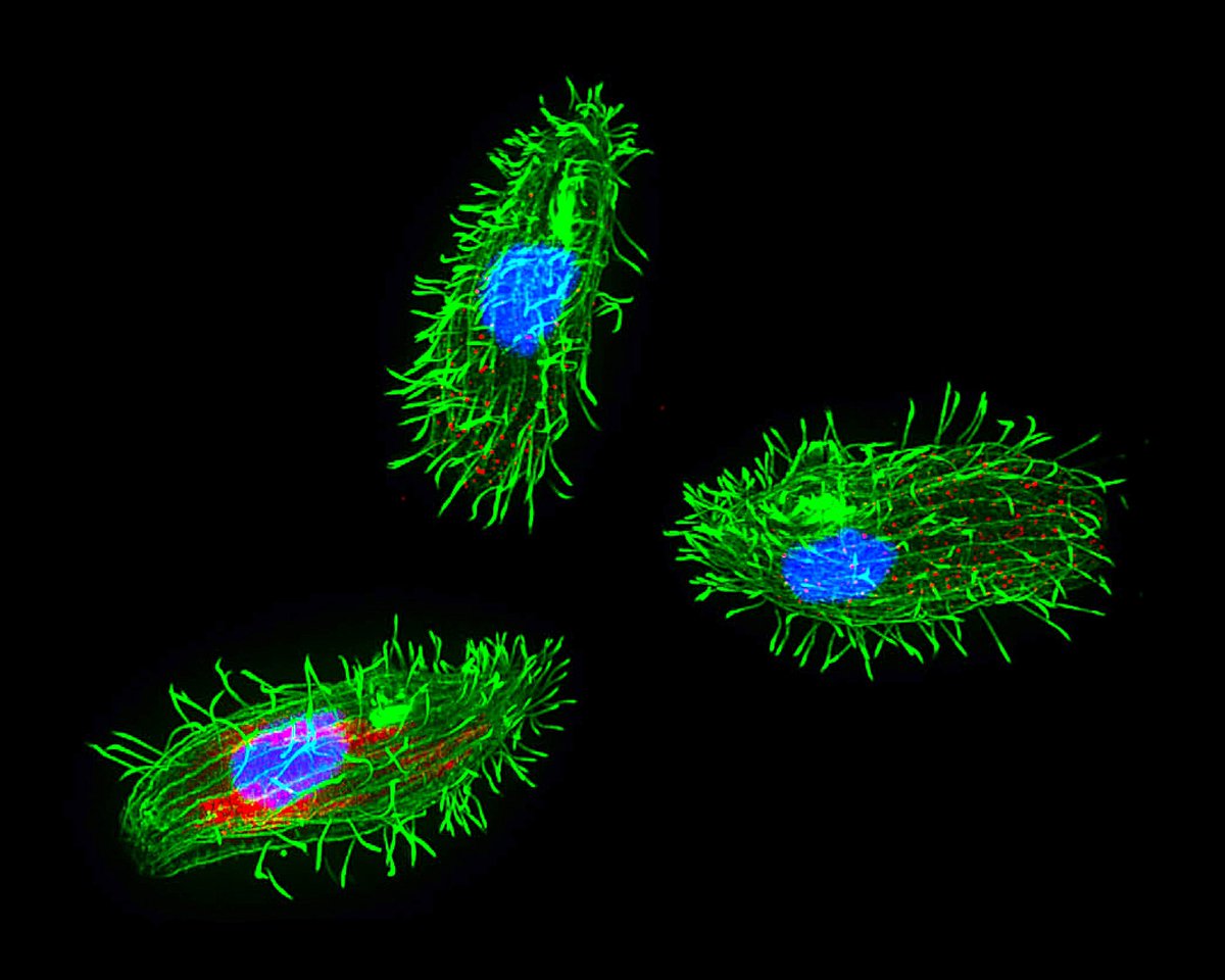 MAG2ART's tweet photo. Three ciliates (single-cell organisms) photographed through a microscope.
#CellBiology #microscopy #SciArt https://t.co/ei63zgrHmF
