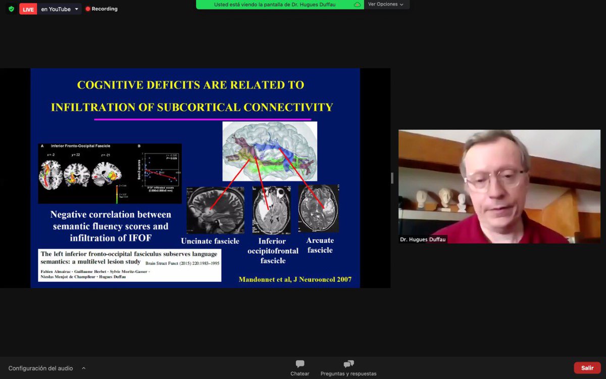 cienhus's tweet photo. Right now in the 2021-IWBNC 🤓🙌🏼

Full agenda on: https://t.co/NS2xELwxoP
Free registration: https://t.co/NlorCr5I3c
#Neurosurgery #MedEd https://t.co/j26IUD5p4R