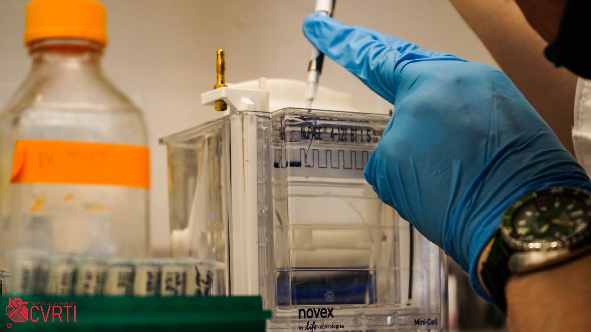 NEH_CVRTI's tweet photo. Don't flinch!
Steven Valdez loads the samples in a #polyacrylamide gel โ very carefully - in the Shaw Lab (@RobinShawCVRTI).
#epeeps #phdchat #cardiotwitter #CVRTI https://t.co/oI1PxxQtUf